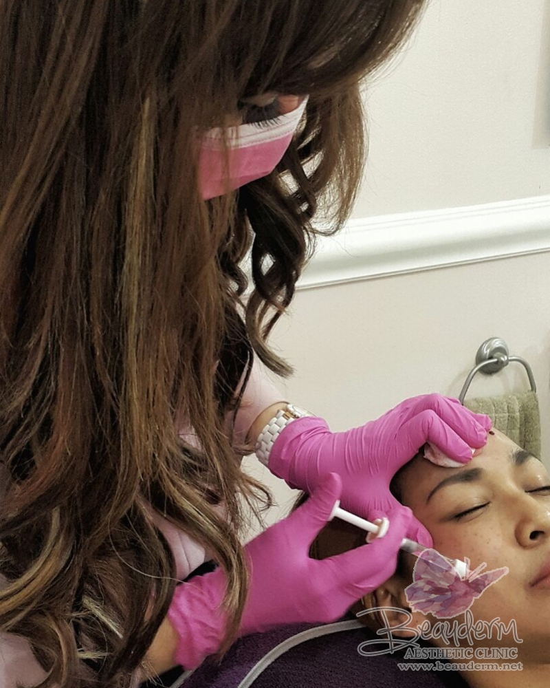 Apa itu Hyaluronic Acid Dan Filler Treatment Serta Manfaat Yang Diharapkan